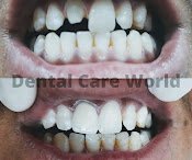 Before and after dental treatment result - unnamed (6).jpg